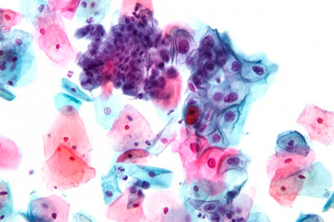 Кокковая флора