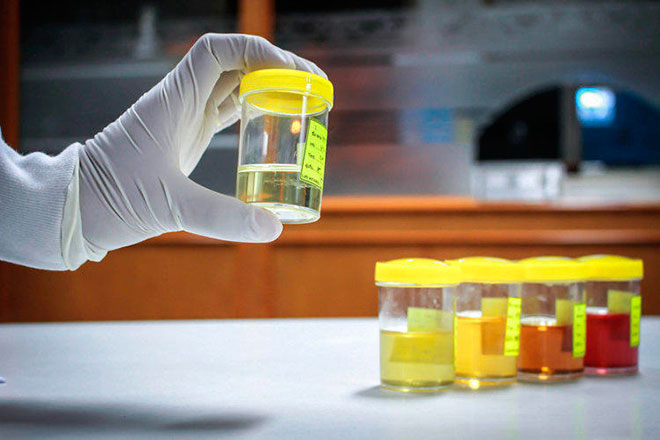 Klebsiella pneumoniae