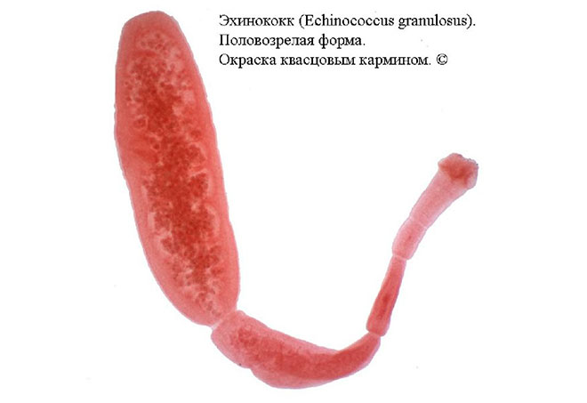 Симптомы эхинококкоза