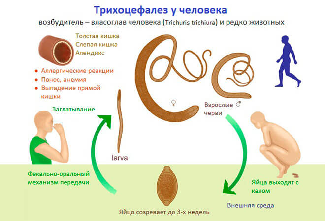 Трихоцефалез